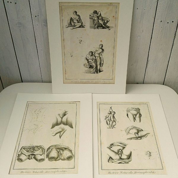 Trois gravures XVIIIème, représentant l'anatomie des hermaphrodites. Quelques rousseurs et tâches quelques traces de froissage. Idéal pour une cabinet de curiosité. 45 x 33 cm